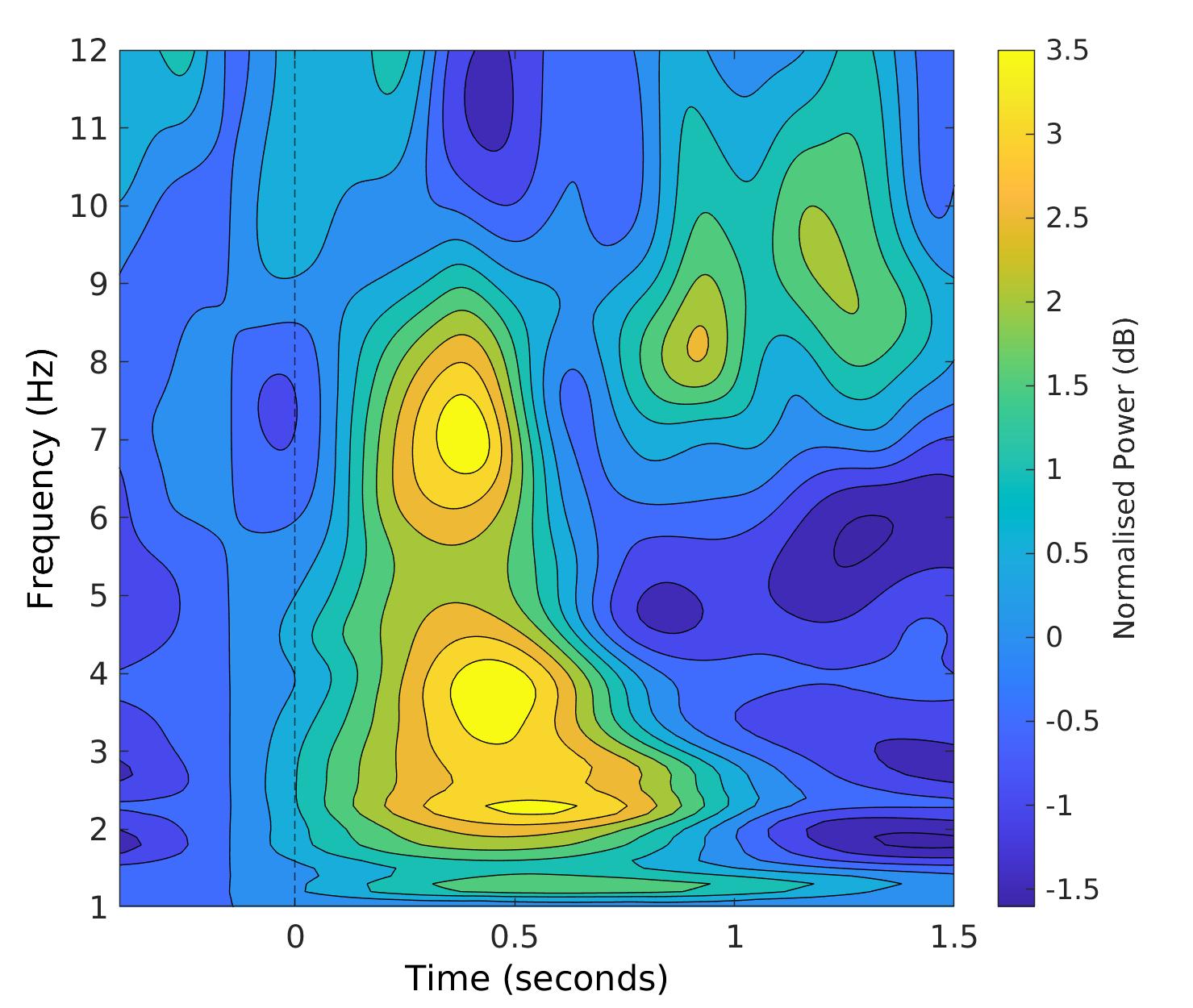 Placeholder for the time-frequency ErrP decomposition figure