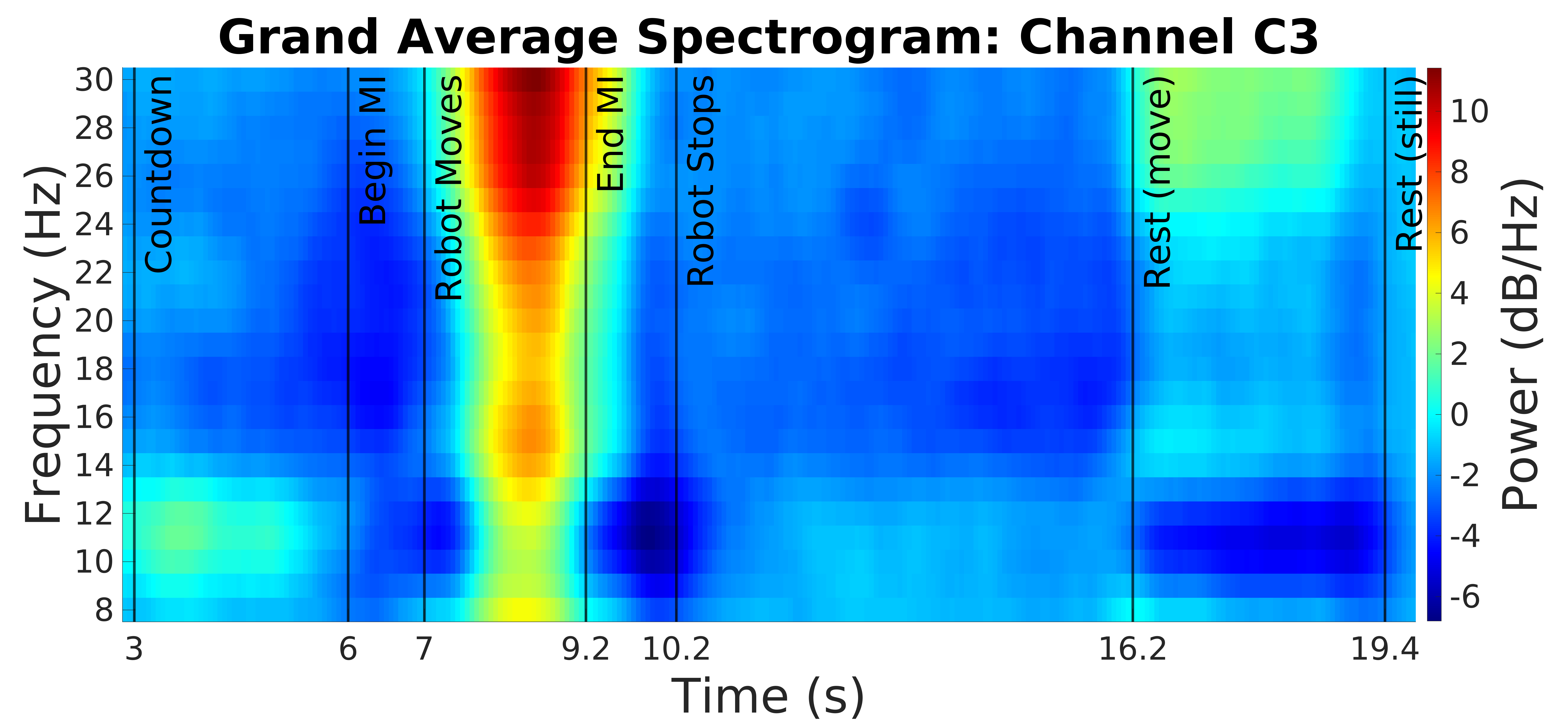Grand average spectrogram placeholder for the C3 region